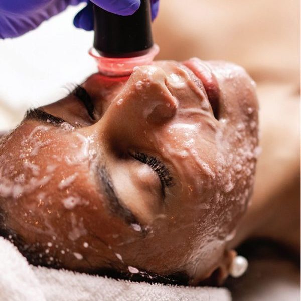 Oxygen Facial